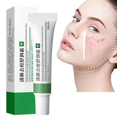 Effective Acne Removal Cream Acne Treatment Fade Acne Spots Oil Control Shrink Pores Whitening Moisturizing Acne Cream