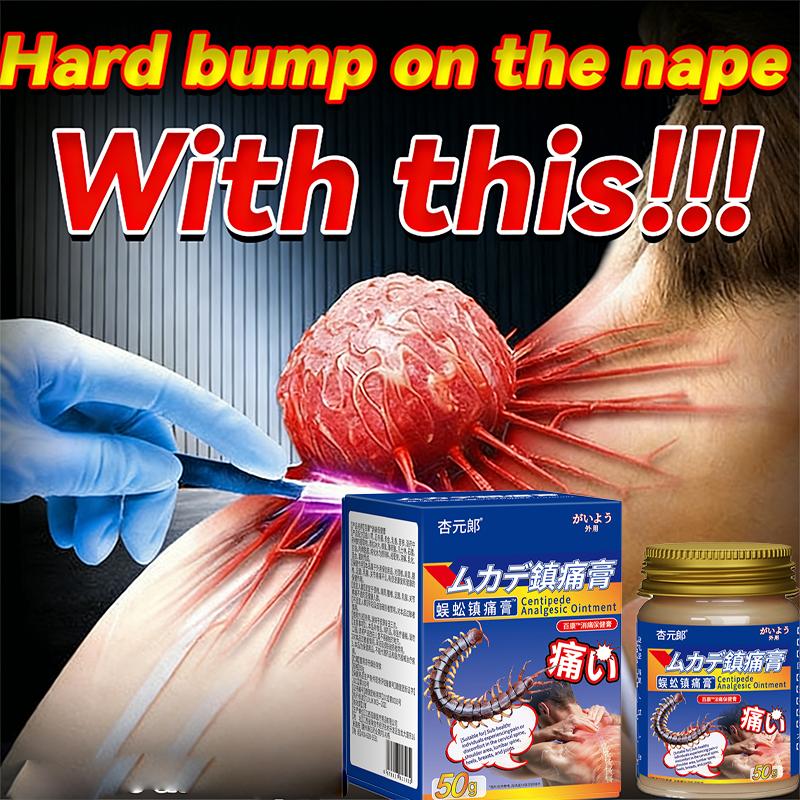 Сглаживающая мазь от шейного выступа - Уменьшает выпуклости и скованность шеи