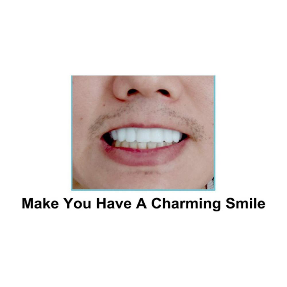 Simulation Tooth Cover Set - Upper & Lower Guards + 2 Dental Waxes for Natural Smile Enhancement, Food-Safe Wear