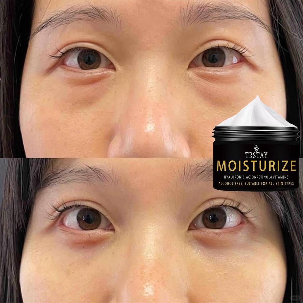 Výkonný oční krém s účinky proti stárnutí a hydratací pro hladší pleť