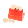 Dental 4 Times Implant Teeth Model Analysis Crown Bridge Demonstration Removable Model Dentistry Study Training Teaching Model
