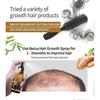 1-3x Biotin Hair Growth Spray Anti Hair Loss Fast Regrowth Scalp Treatment Serum 20ml for Men & Women