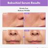TOSOWOONG Bakuchiol Serum