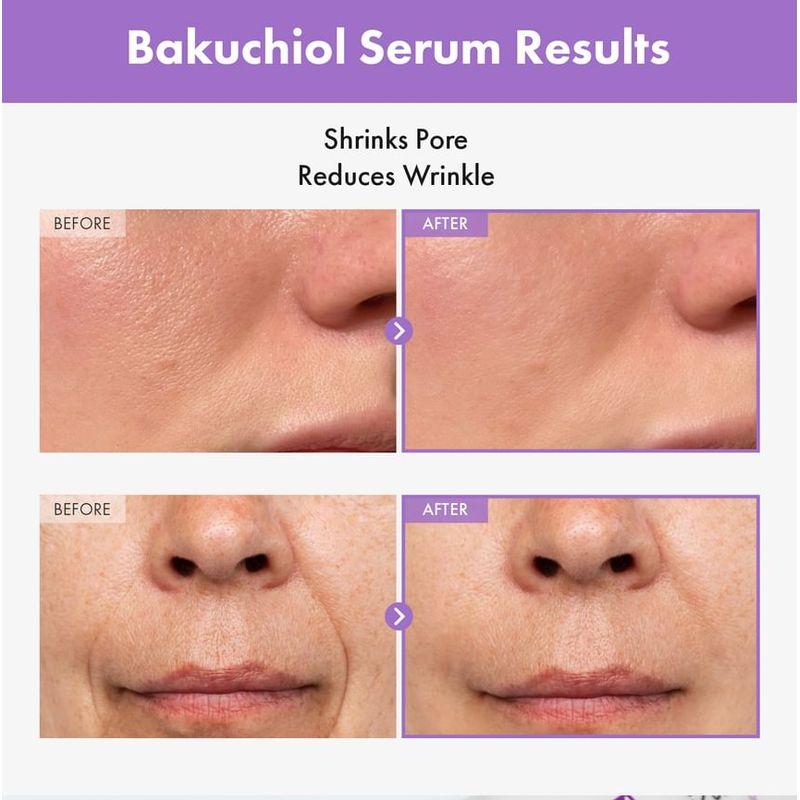 TOSOWOONG Bakuchiol Serum