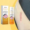 XIMONTH Bee Venom Repair Spray Promotes Skin Repair and Improves Scars Mild Formula Deeply Nourishes