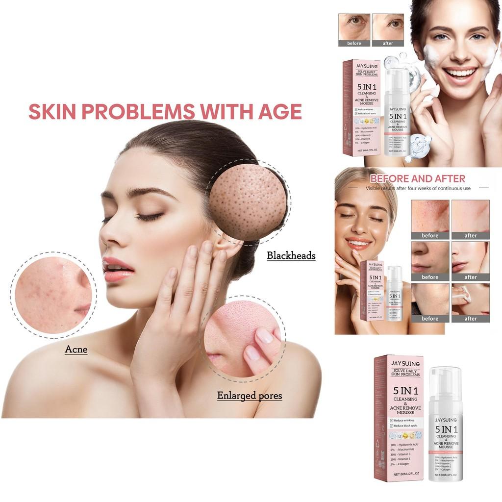 Jaysuing 5 In 1 Cleansing Mousse For Deep Pore Cleansing And Oil Control 60ml