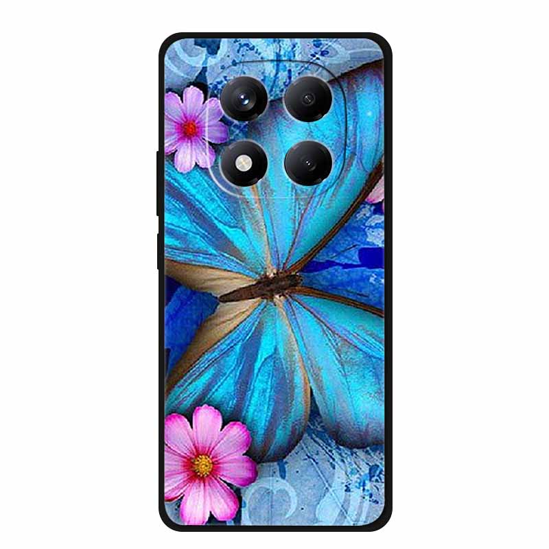 

For Xiaomi Redmi Note 15 Pro / Note 15 Pro+ 5G Case Global Version 25060RABDG 2510ERA8BG Luxury Soft Silicone Back Cover Cases Note15 ProPlus Globa