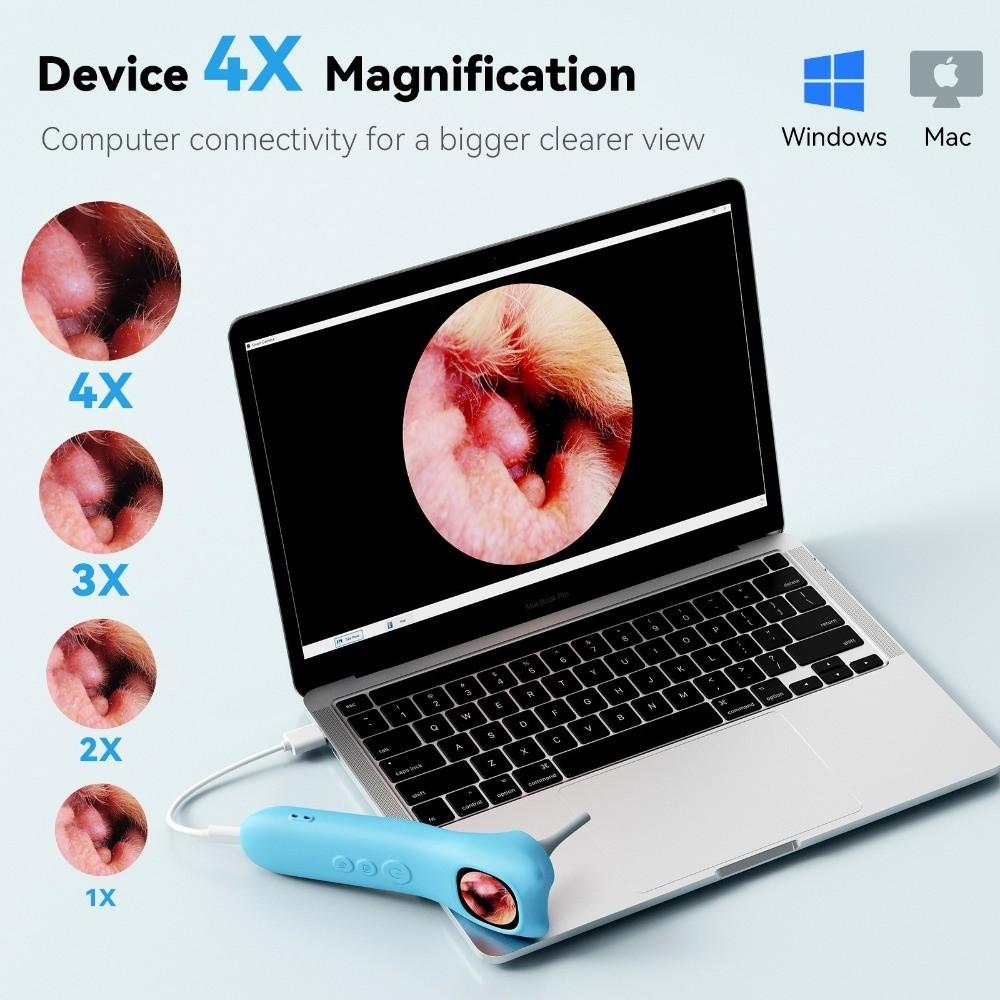 1080P HD Ear Camera 1.21 Inch IPS Screen Visual Ear Care Durable Smart Detector  Ear Care