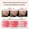 HBN Alpha Arbutin Brightening & Hydrating Sheet Mask