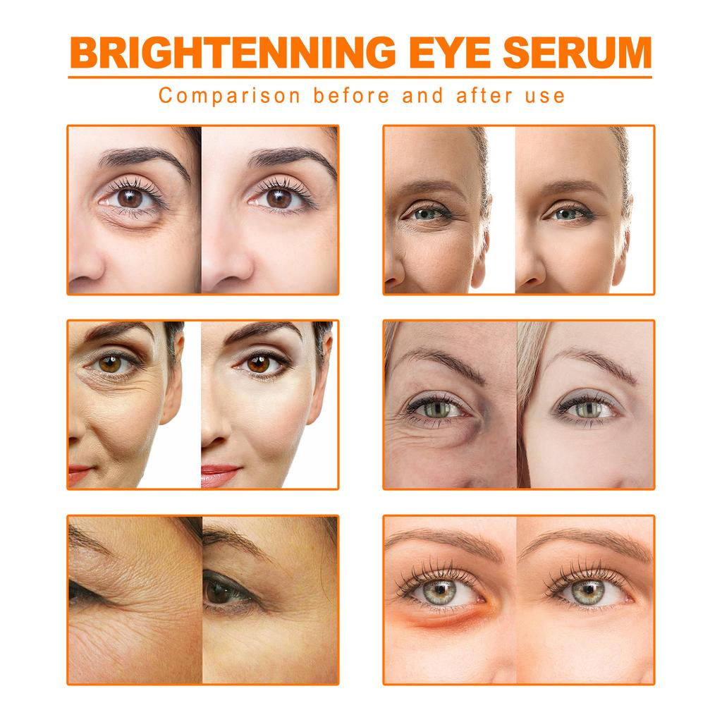 Vitamin C Remove Dark Circle Eye Cream Anti Wrinkle Fade Fine Line Eye Bags Serum Lift Firming Anti-Aging Eye Skin Care Products