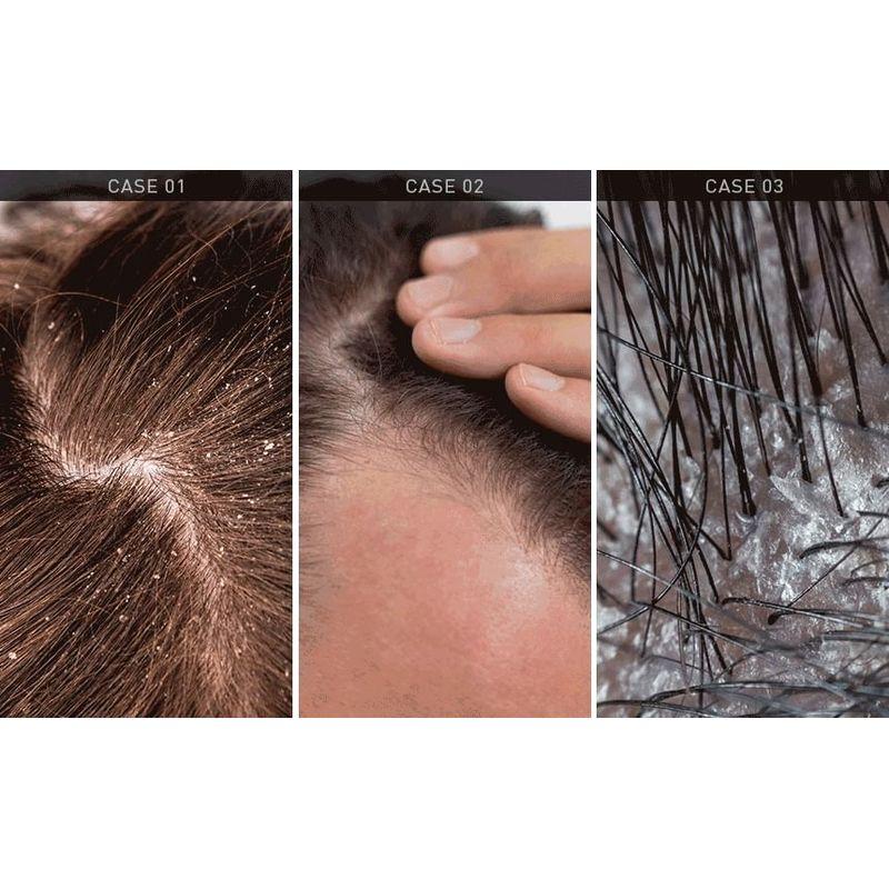 ViveLab Revi Solution Anti Hair Loss Scalp Shampoo