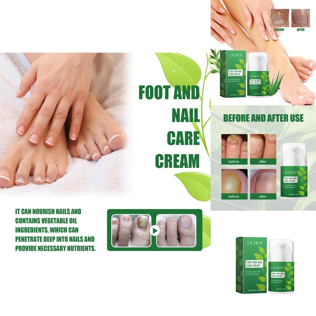 Ouhoe Nourishing Foot And Nail Care Cream For Soft Moisturized Healthy Feet