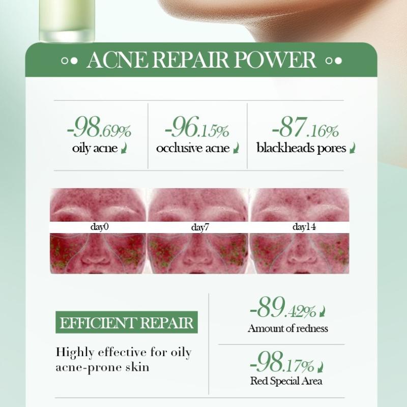 Salicylic Acid Nourishing Essence Milk SADOER Moisturizing Hydrating Refreshing Water Milk
