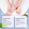Nail Fungus Treatment Serum Spray Repair Dryness Cracking Infection Fungal Nail Remove Inflammation Swelling Foot Care Products