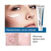 1X Tranexamic Acid CREAM | Skin Freckle Cream, Blemishes, Anti-pigmetation
