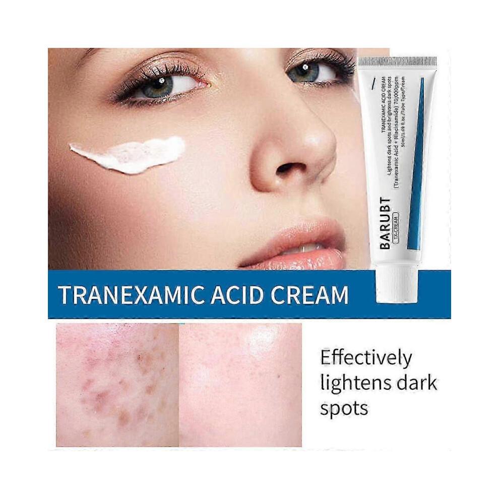 1X Tranexamic Acid CREAM | Skin Freckle Cream, Blemishes, Anti-pigmetation