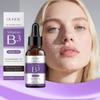 Vitamin B3 Gesichtsserum Niacinamid 5% Vitanin E Hyaluronsäure Entfernen Sie schwarze Flecken Sommersprossen Aufhellen Melanin-Pigmentierung