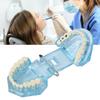 Dental Pathological Model Clear Teaching Detachable Dental Teeth Display Model Blue Transparent