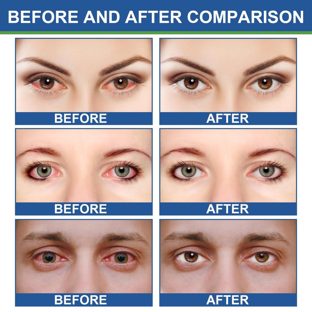 South Moon Eye Balm Gentle Moisturizing & Nourishing Eye Relief Daily Eye Care Balm