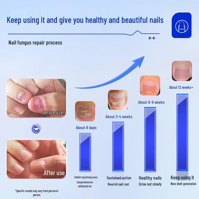 Tong Ren Tang Fungal Nail Repair Solution