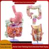 Patologicko-anatomický model lidského tlustého střeva: Slepé střevo, Konečník, Dvanáctník