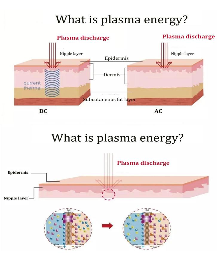 Profesionální ozónové plazmové pero pro zmírnění stárnutí pleti, omlazení pleti, bělení, léčbu akné, plazmové pero