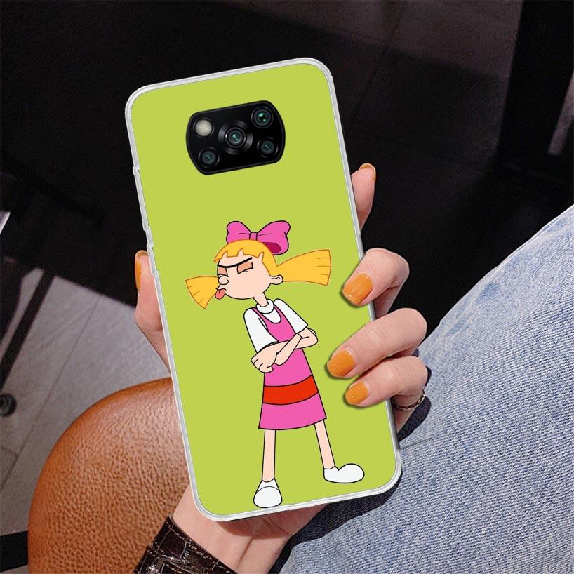 Cartoon Hey Arnold Fondos Phnoe Case for Xiaomi Poco X5 X6 X7 Pro X4 Gt F7 Ultra M8 M7 Redmi 15C 15 13C 13 12C 12 Unique Cover C