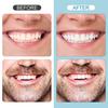 6Pcs with Moldable Thermal Beads DIY Tooth Repair Kit Upper Veneer Cosmetic Tooth  Oral Health