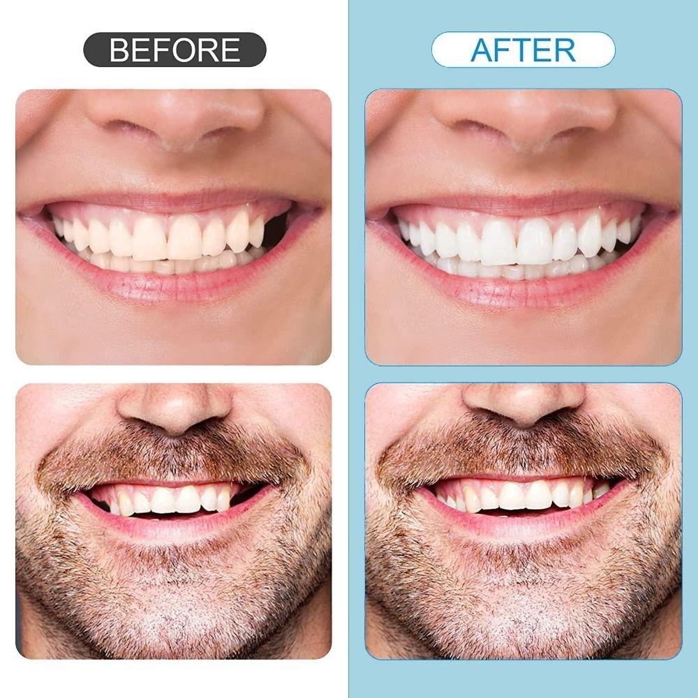 6Pcs with Moldable Thermal Beads DIY Tooth Repair Kit Upper Veneer Cosmetic Tooth  Oral Health