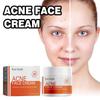 West Month Salicylic Acid Facial Mask Gentle Cleansing Reduces Acne Scars Pore Tightening