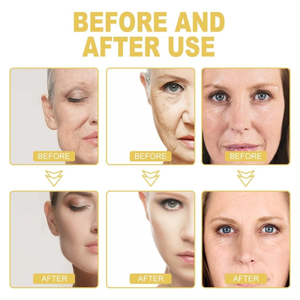 Eelhoe Hydrating Anti-aging Facial Serum Deeply Moisturizes Restores Skin Elasticity And Reduces Fine Lines