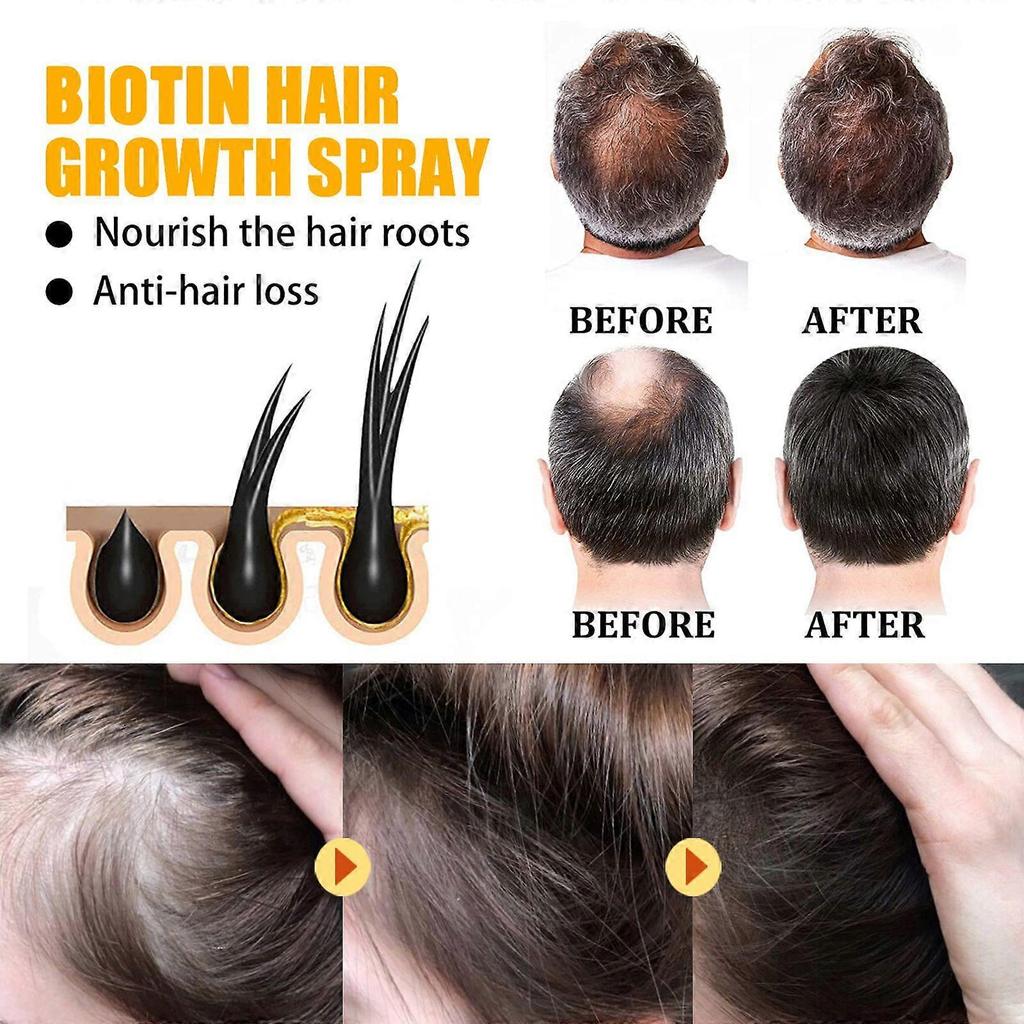 Biotin Hair Growth Spray: Strengthens, Prevents Hair Loss, Repairs, Nourishes, and Protects Hair Roots