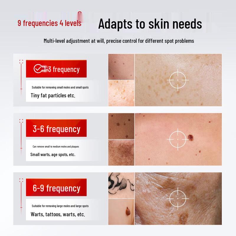 Picosecond Laser Spot & Tattoo Removal Device