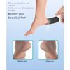 Round Moon Foot File For Effective Exfoliation Nonallergenic Glass Face Professional Pedicure Tool Long Permanent ABS Building
