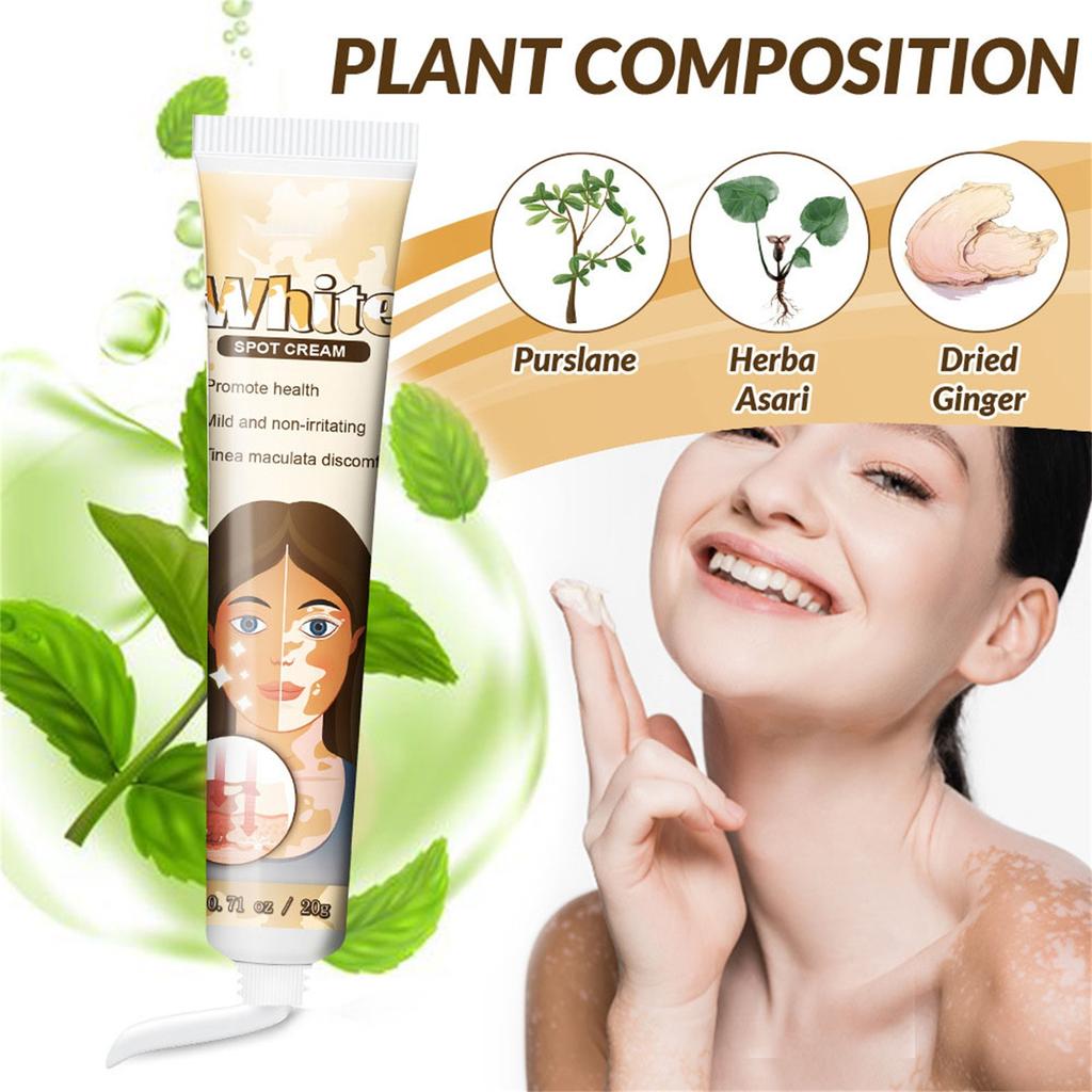 Vitiligo Cream, Natural Vitiligo Ease For Skin Vitiligo, Vitiligo Care Cream, Reduce Spots And Improve Skin Pigmentation, Easy To Use