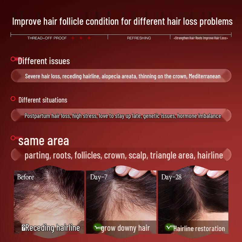Vitas Anti-Hair Loss & Hair Growth Liquid 95ml