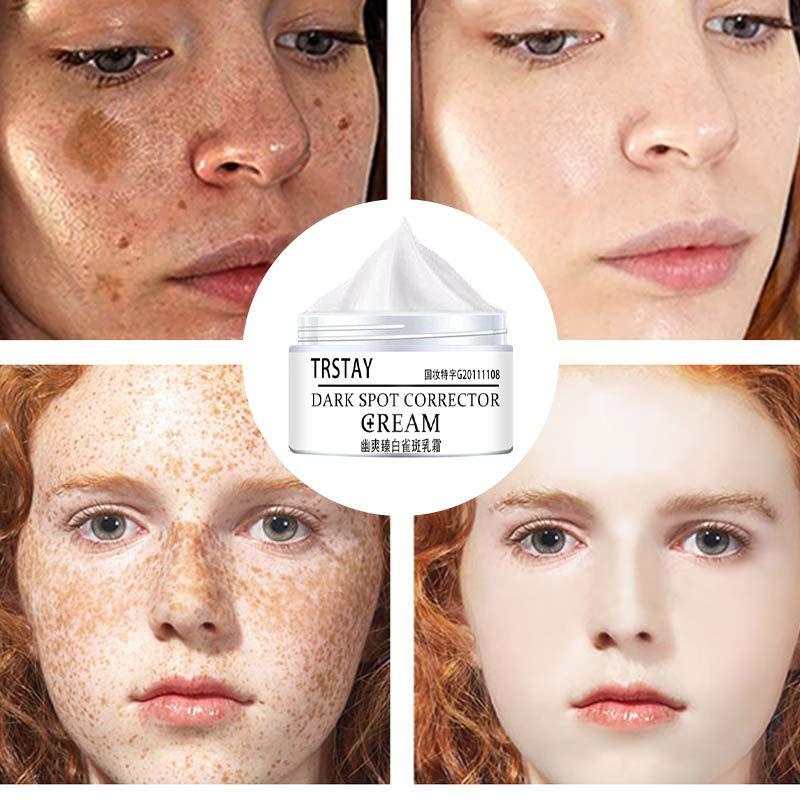 

Уход за кожей лица, крем для глаз, отбеливающий крем для лица, лифтинг-крем для лица, коллаген, против старения, восстановление морщин, увлажнение