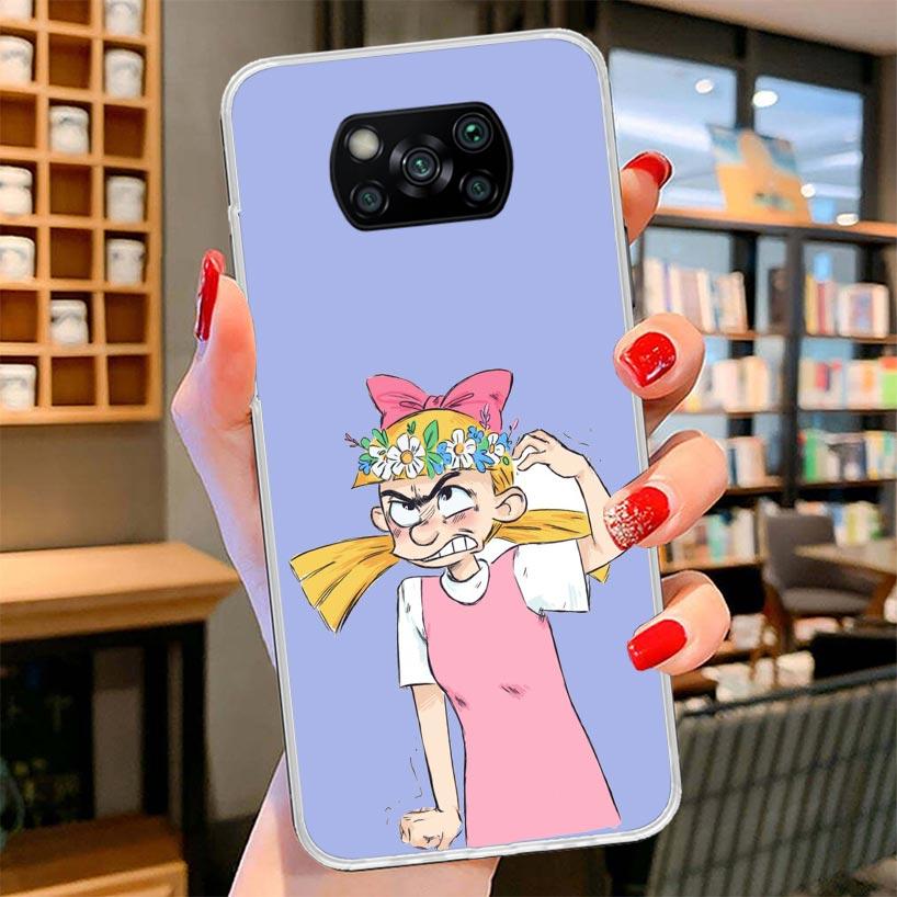 Cartoon Hey Arnold Fondos Cover Phone Case For Xiaomi Poco F7 Ultra X7 X6 X5 Pro M7 Redmi 15C 15 13C 13 12C 12 10C 10 9A 9C 9T 9