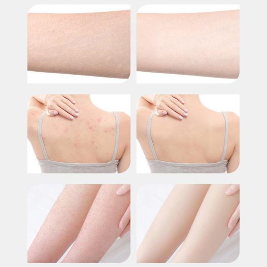 Super Soft Sunflower Suction Cup Bath Ball 2-in-1 Exfoliating Bath Sponge with Massage Function Soft Massage Shower Ball