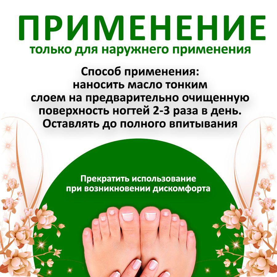 5ml Nail Removal Oil For Onychomycosis