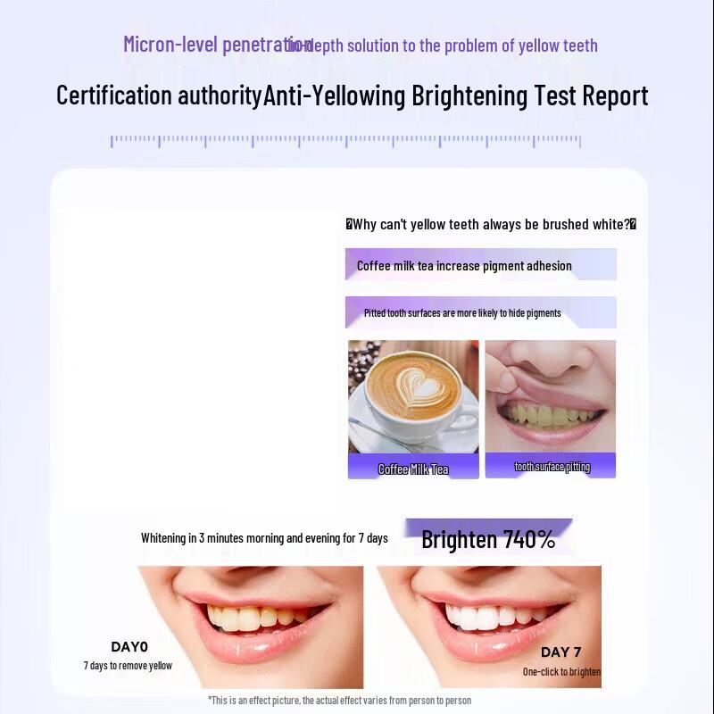 Saky Professional Whitening Enzyme Toothpaste