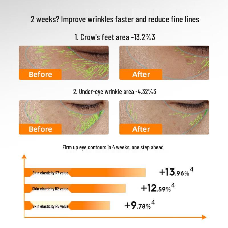 ZHAN MEI YA Tie Gu Pro Lifting & Firming Eye Cream 15g