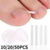 10/20/50 PIÈCES Outil de Correction d'Ongle Incarné Traitement Ongle Incarné Patch Autocollant Élastique Clip Redresseur Attelle Outil de Pédicure
