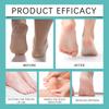 Foot Keratin Remover, Keratin Removal Spray, For Heel Calluses And Dead Skin Foot Care Spray,20ml