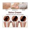 Treatment Cream Relieve Venous Herniation Improve Vasculitis Phlebitis Spider Leg Care Promote