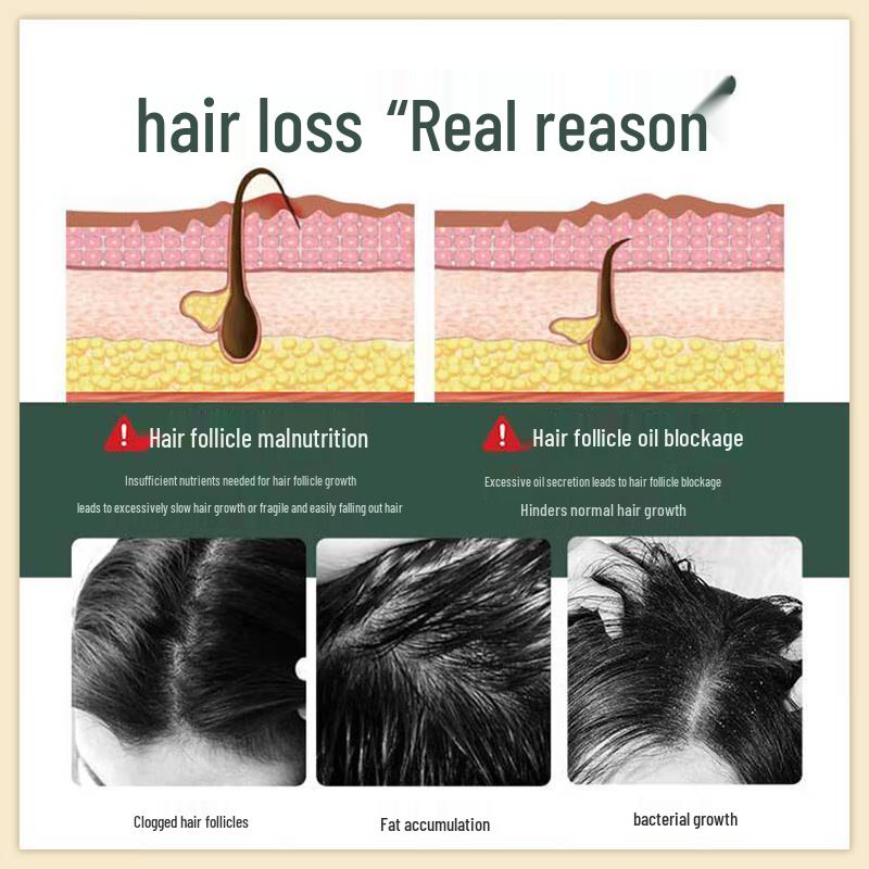 Tonerun Hair Growth & Black Hair Care Herbal Shampoo