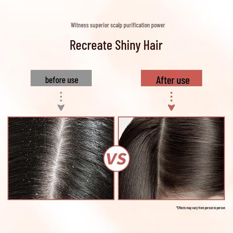 Siyuan Tea Seed Anti-Dandruff Shampoo