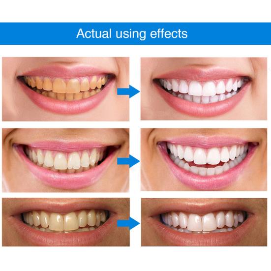 4ml Teeth Whitening Pen Stain Remove Protect Gum Teeth Repair Quick Acting Teeth Whitening Pen for Beauty
