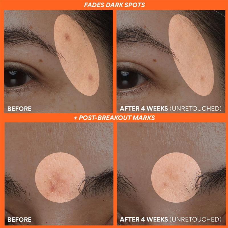 Innisfree Serum rozjaśniające z witaminą C i zieloną herbatą 30ml