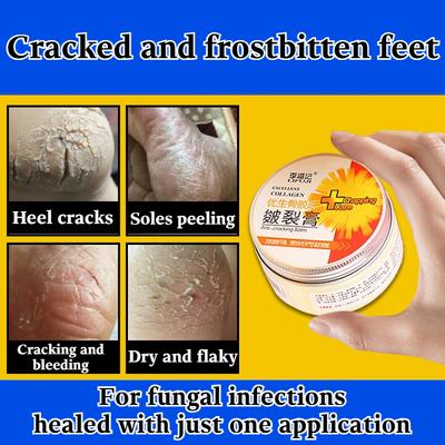 Creme für rissige Füße, rissige Fersen, rissige Schrunden, Pilzinfektionen, Spezialcreme für Frostbeulenrisse an Händen und Füßen